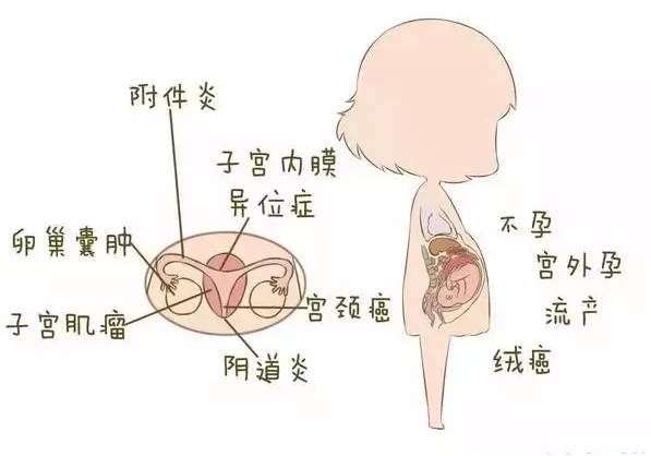 温州妇科医院宫颈肥大患者要注意哪些问题？